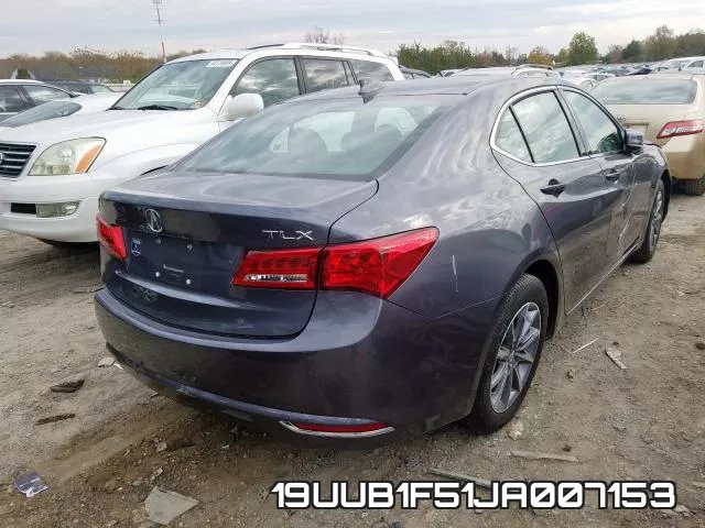 19UUB1F51JA007153 фото 3
