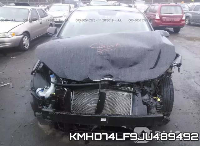 KMHD74LF9JU489492 фото 7