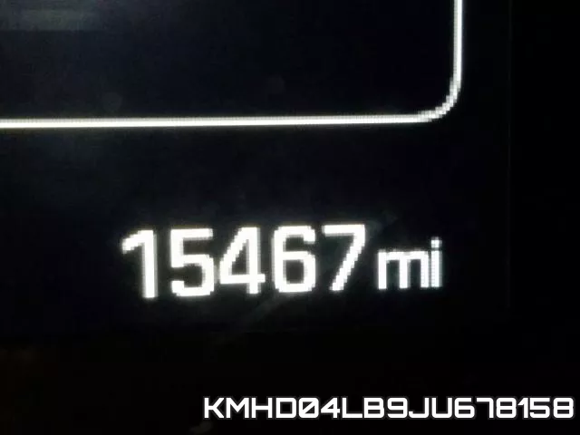 KMHD04LB9JU678158 фото 6