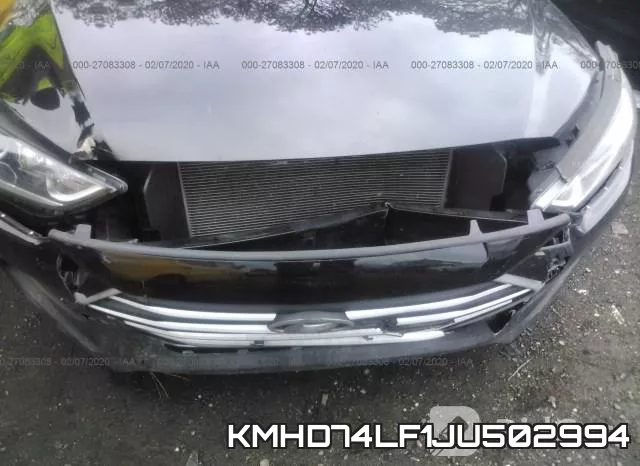 KMHD74LF1JU502994 фото 6
