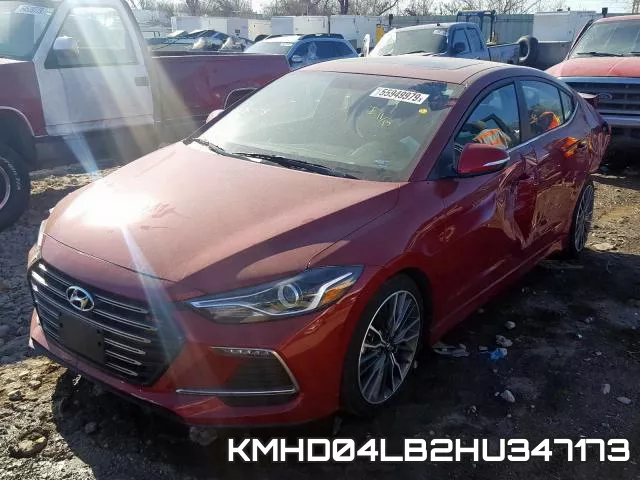 KMHD04LB2HU347173 фото 3