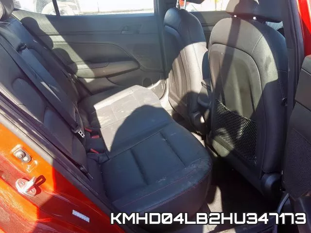 KMHD04LB2HU347173 фото 6