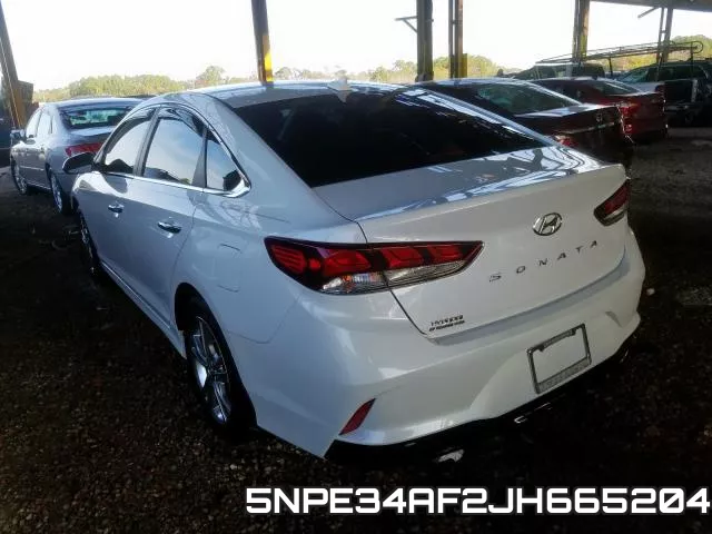 5NPE34AF2JH665204 фото 4