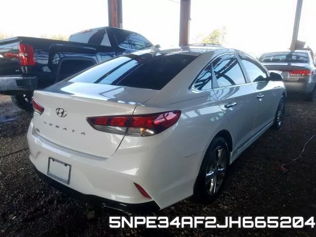 5NPE34AF2JH665204 фото 5