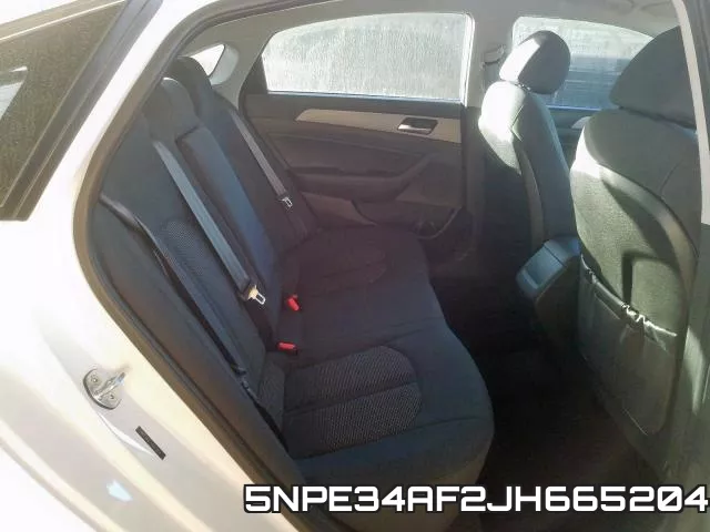 5NPE34AF2JH665204 фото 6
