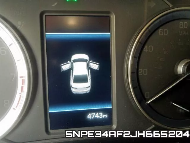 5NPE34AF2JH665204 фото 8