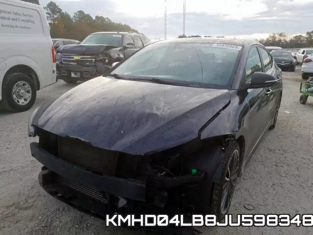 KMHD04LB8JU598348 фото 2