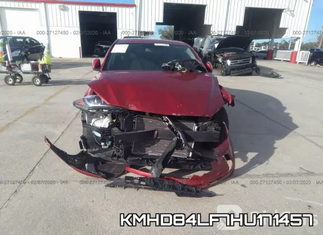 KMHD84LF7HU171457 фото 5