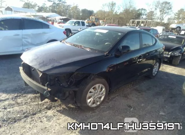 KMHD74LF1HU359197 фото 3