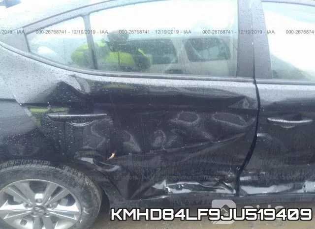 KMHD84LF9JU519409 фото 7