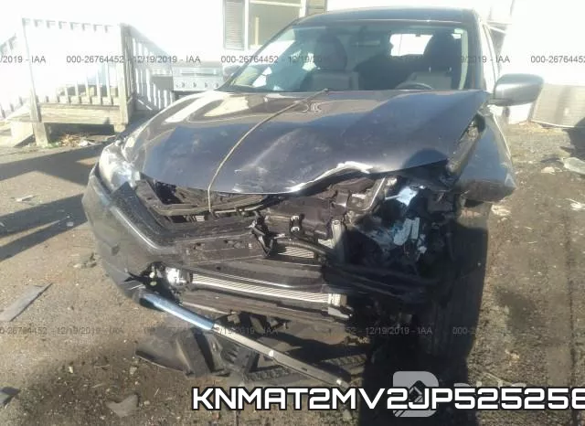 KNMAT2MV2JP525258 фото 6