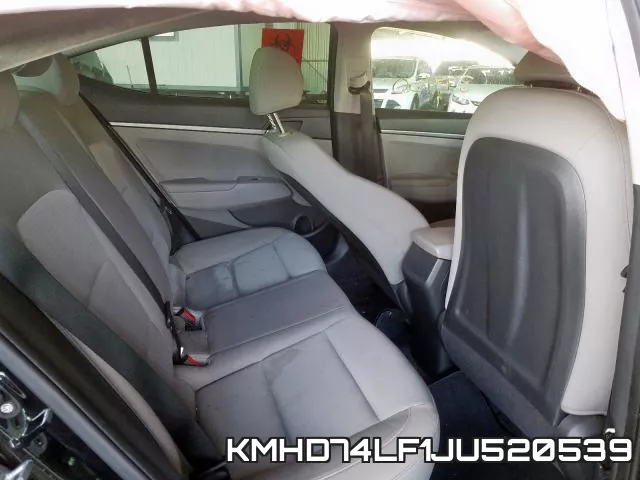 KMHD74LF1JU520539 фото 3