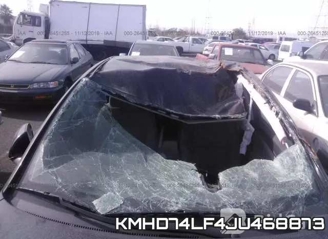 KMHD74LF4JU468873 фото 3