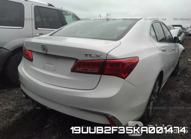 19UUB2F35KA001474 фото 5