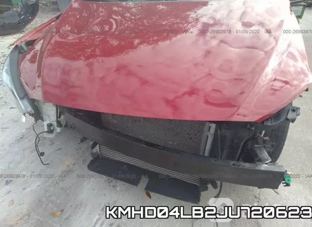 KMHD04LB2JU720623 фото 6