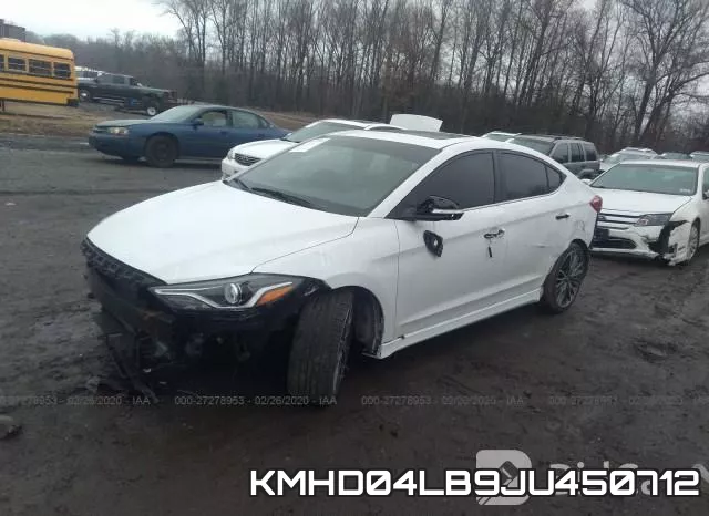 KMHD04LB9JU450712 фото 2
