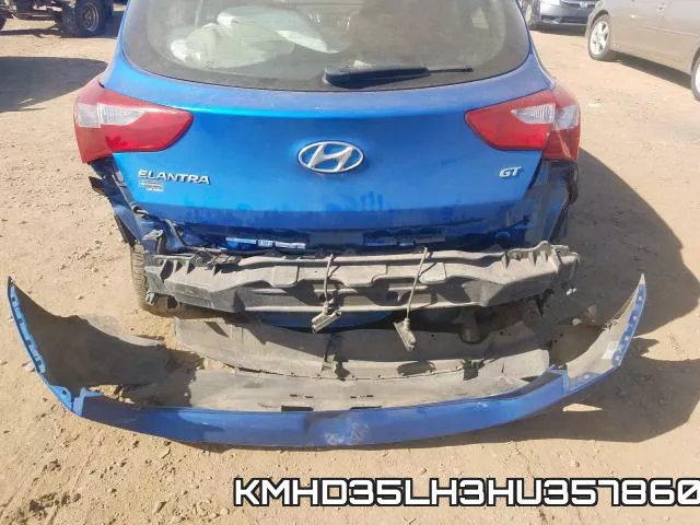 KMHD35LH3HU357860 фото 8