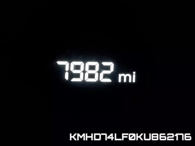 KMHD74LF0KU862176 фото 8
