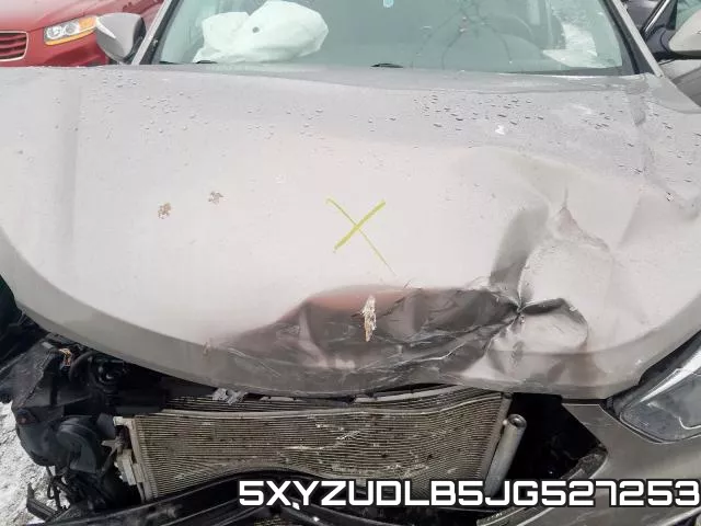 5XYZUDLB5JG527253 фото 7
