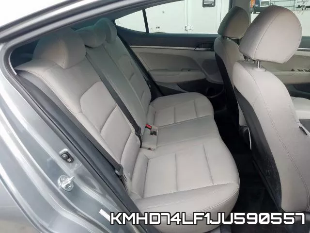 KMHD74LF1JU590557 фото 6