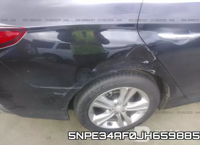 5NPE34AF0JH659885 фото 5