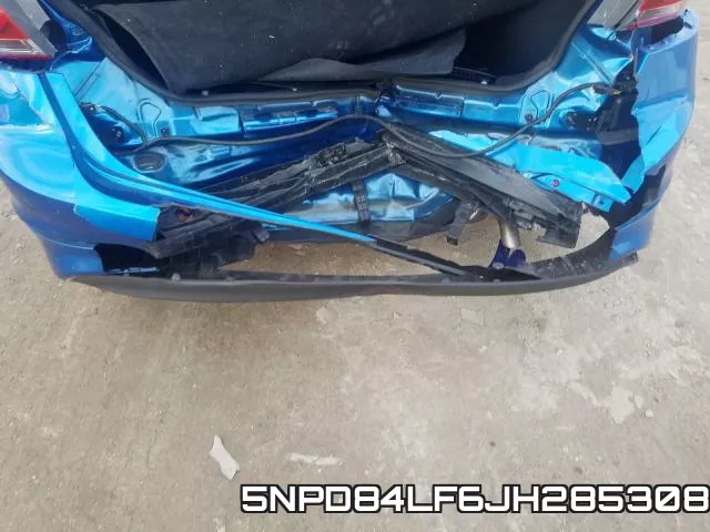 5NPD84LF6JH285308 фото 8