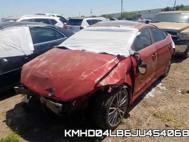 KMHD04LB6JU454068 фото 3
