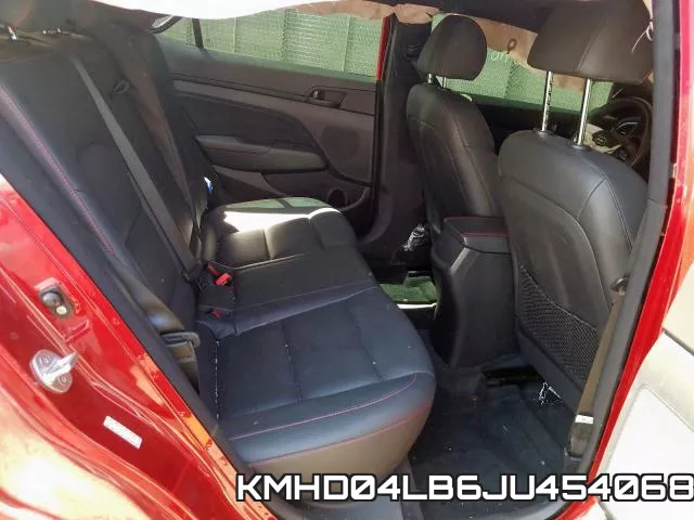 KMHD04LB6JU454068 фото 4