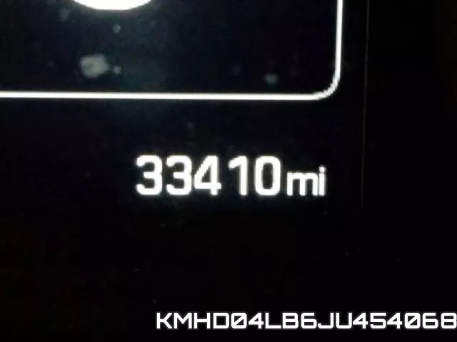 KMHD04LB6JU454068 фото 6