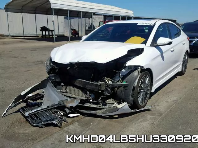 KMHD04LB5HU330920 фото 2