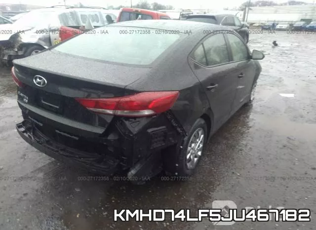 KMHD74LF5JU467182 фото 5