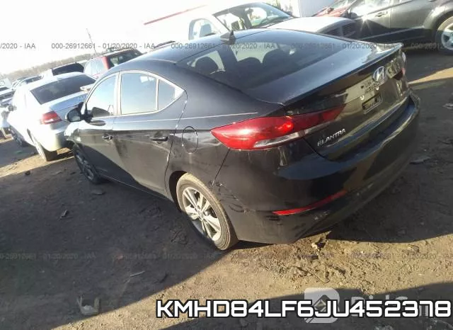 KMHD84LF6JU452378 фото 3