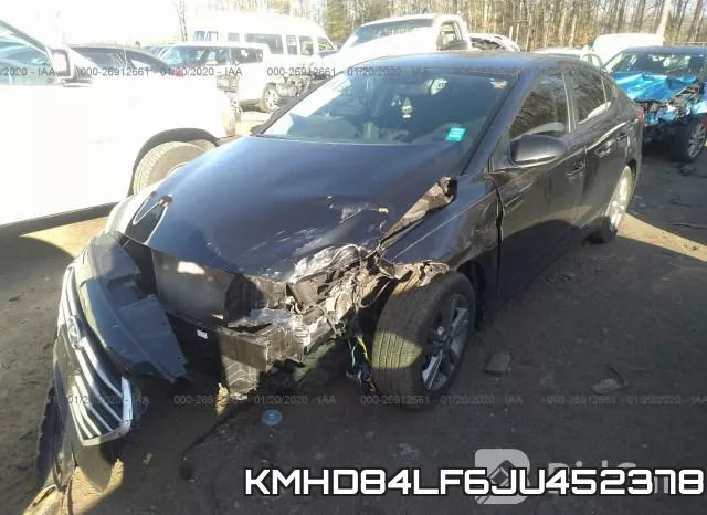 KMHD84LF6JU452378 фото 5