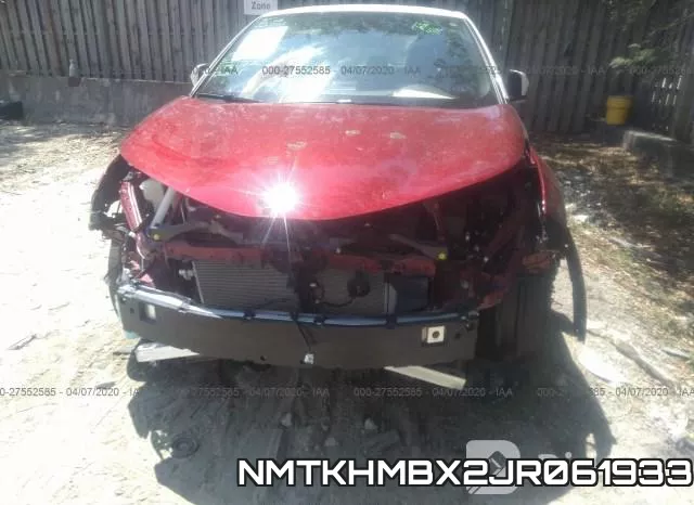 NMTKHMBX2JR061933 фото 4