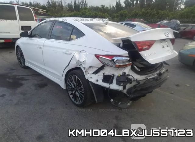 KMHD04LBXJU557123 фото 2