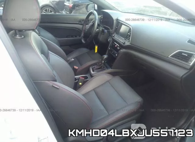 KMHD04LBXJU557123 фото 4