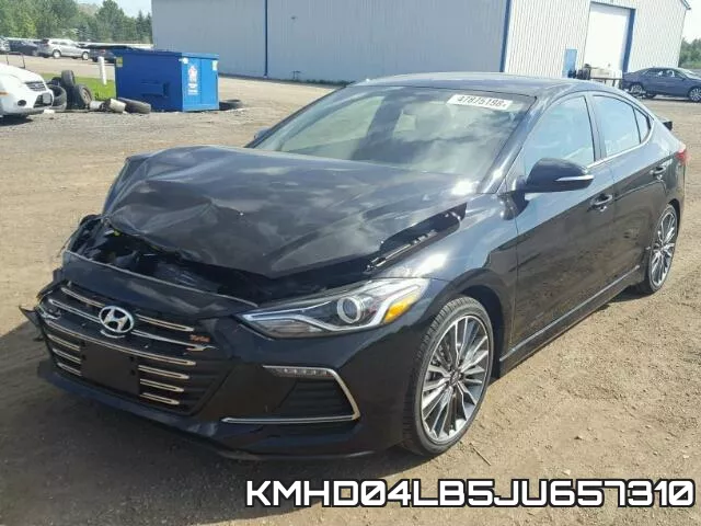 KMHD04LB5JU657310 фото 3