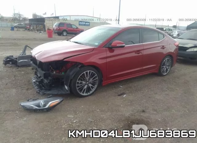 KMHD04LB1JU683869 фото 3