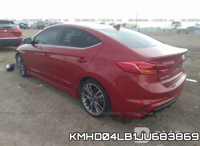 KMHD04LB1JU683869 фото 4