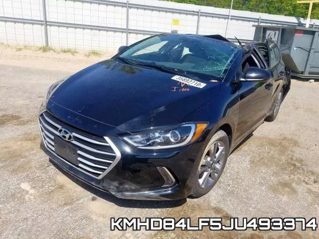 KMHD84LF5JU493374 фото 3