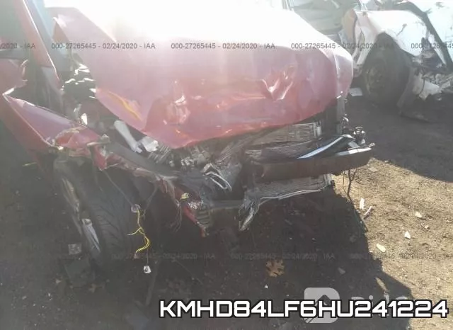 KMHD84LF6HU241224 фото 4