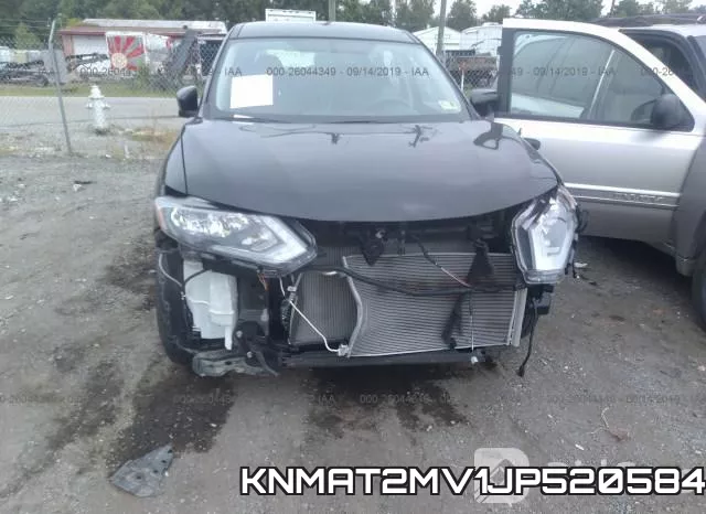KNMAT2MV1JP520584 фото 7