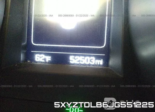 5XYZTDLB6JG551225 фото 8