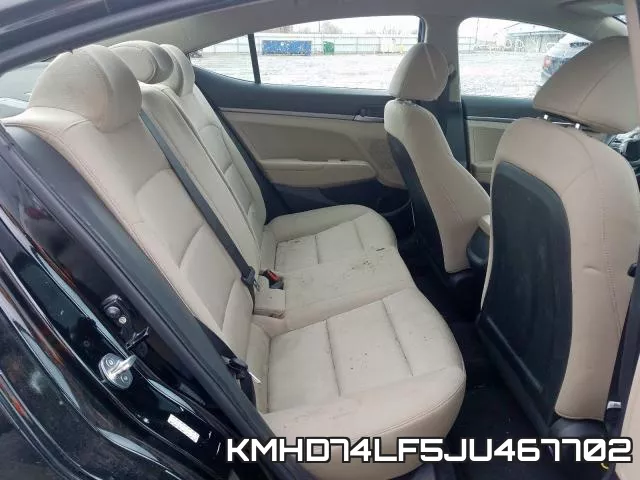 KMHD74LF5JU467702 фото 7