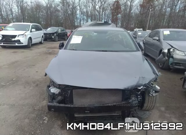 KMHD84LF1HU312992 фото 4