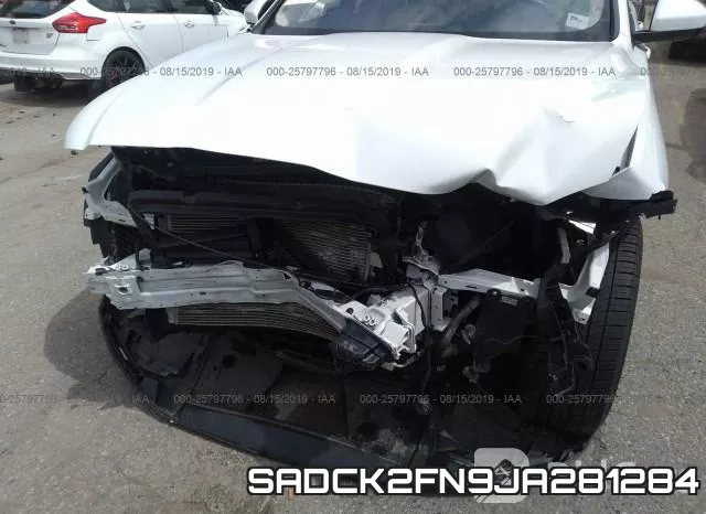 SADCK2FN9JA281284 фото 7