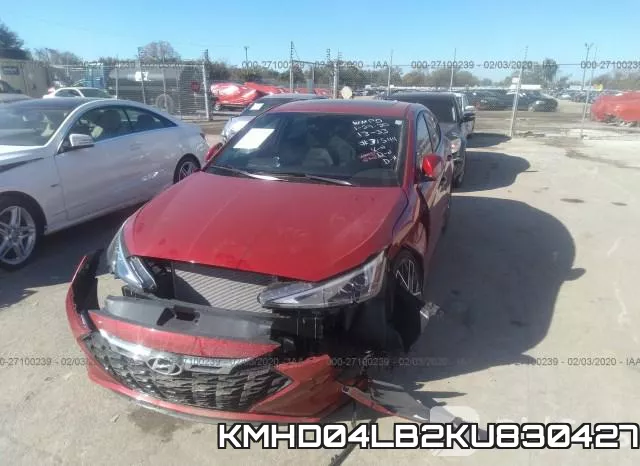 KMHD04LB2KU830427 фото 7