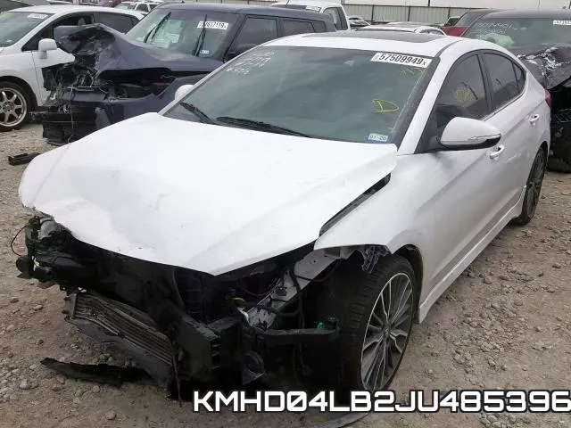 KMHD04LB2JU485396 фото 3