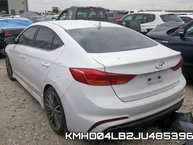 KMHD04LB2JU485396 фото 4