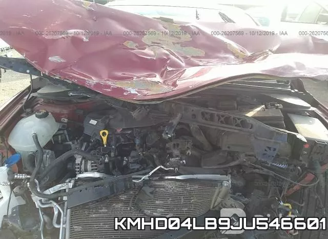 KMHD04LB9JU546601 фото 2